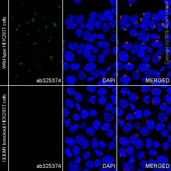 Immunocytochemistry/ Immunofluorescence - Alexa Fluor® 488 Anti-GOLM1/GOLPH2 antibody [EPR29022-61] (AB325374)