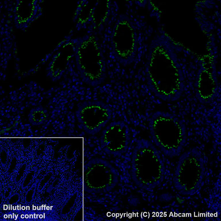 Immunohistochemistry (Formalin/PFA-fixed paraffin-embedded sections) - Alexa Fluor® 488 Anti-GOLM1/GOLPH2 antibody [EPR29022-61] (AB325374)
