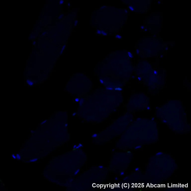 Immunohistochemistry (Formalin/PFA-fixed paraffin-embedded sections) - Alexa Fluor® 488 Anti-GOLM1/GOLPH2 antibody [EPR29022-61] (AB325374)