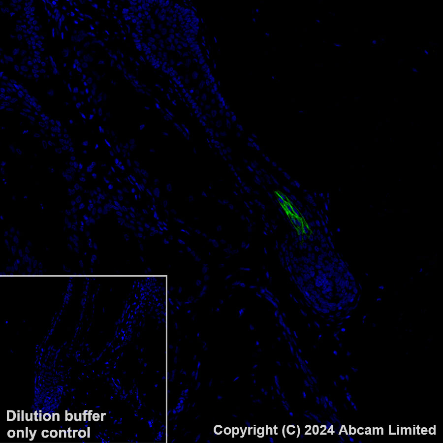 Immunohistochemistry (Formalin/PFA-fixed paraffin-embedded sections) - Alexa Fluor® 488 Anti-GPCR GPRC5D antibody [EPR28376-41] (AB323466), expandable thumbnail