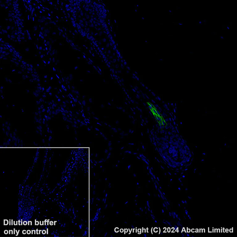 Immunohistochemistry (Formalin/PFA-fixed paraffin-embedded sections) - Alexa Fluor® 488 Anti-GPCR GPRC5D antibody [EPR28376-41] (AB323466)