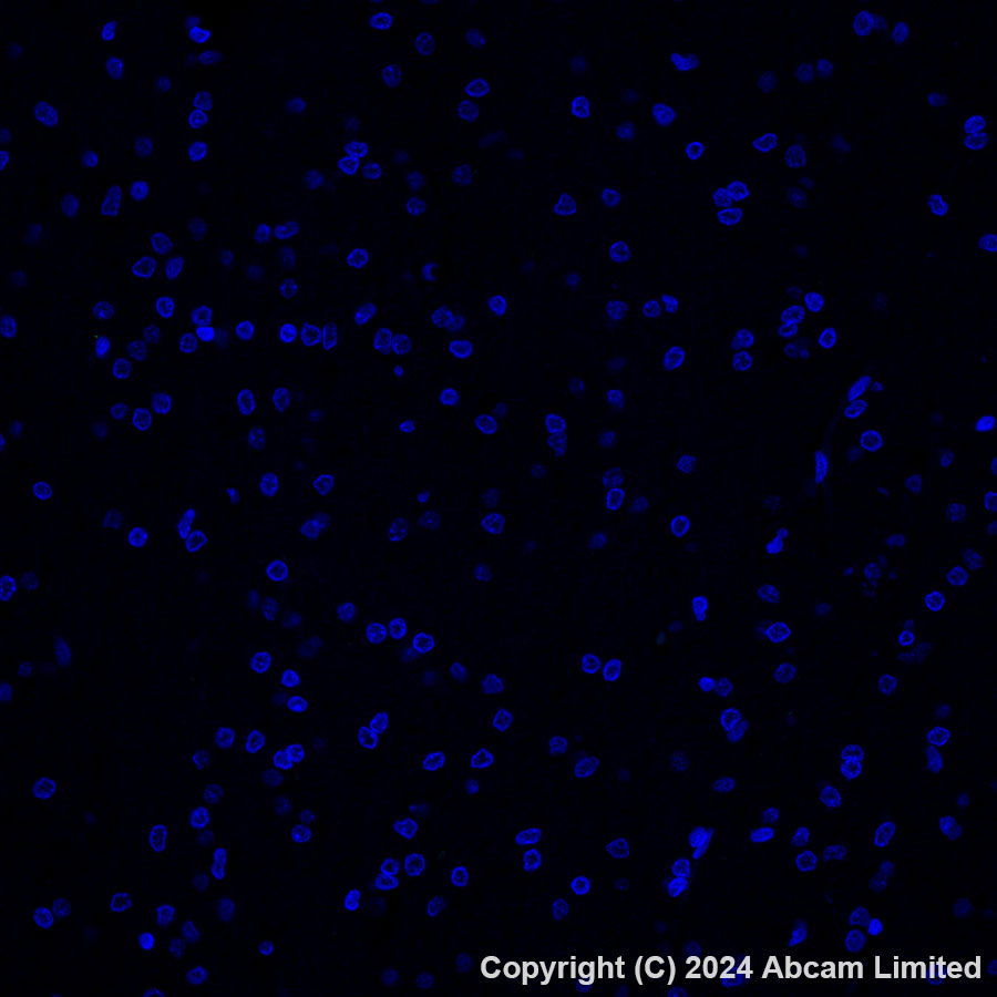 Immunohistochemistry (Formalin/PFA-fixed paraffin-embedded sections) - Alexa Fluor® 488 Anti-GPCR GPRC5D antibody [EPR28376-41] (AB323466), expandable thumbnail