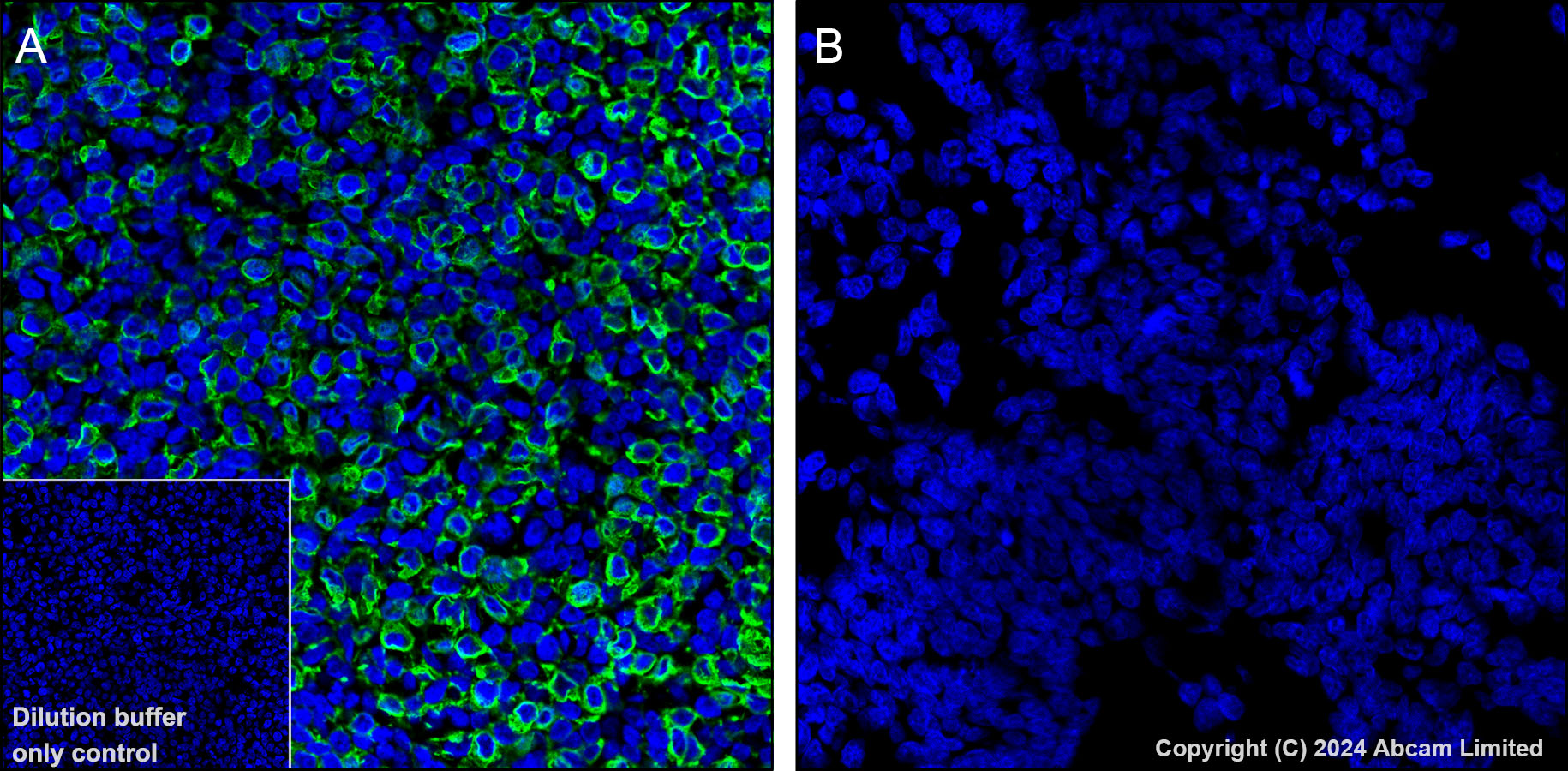 Immunohistochemistry (Formalin/PFA-fixed paraffin-embedded sections) - Alexa Fluor® 488 Anti-GPCR GPRC5D antibody [EPR28376-41] (AB323466), expandable thumbnail