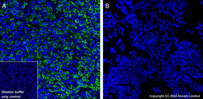 Immunohistochemistry (Formalin/PFA-fixed paraffin-embedded sections) - Alexa Fluor® 488 Anti-GPCR GPRC5D antibody [EPR28376-41] (AB323466)