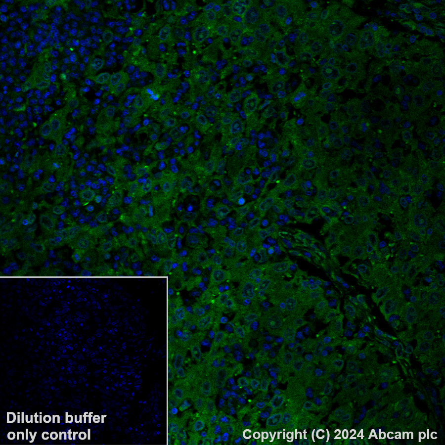 Immunohistochemistry (Formalin/PFA-fixed paraffin-embedded sections) - Alexa Fluor® 488 Anti-GPCR LGR6 antibody [EPR6874] (AB318245)