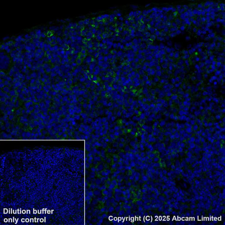 Immunohistochemistry (Formalin/PFA-fixed paraffin-embedded sections) - Alexa Fluor® 488 Anti-GPNMB antibody [EPR29063-10] (AB323762)
