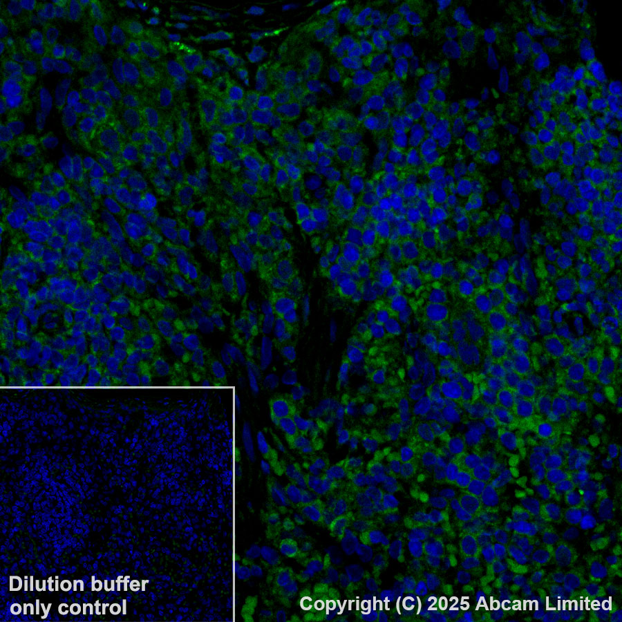 Immunohistochemistry (Formalin/PFA-fixed paraffin-embedded sections) - Alexa Fluor® 488 Anti-GPNMB antibody [EPR29063-10] (AB323762), expandable thumbnail