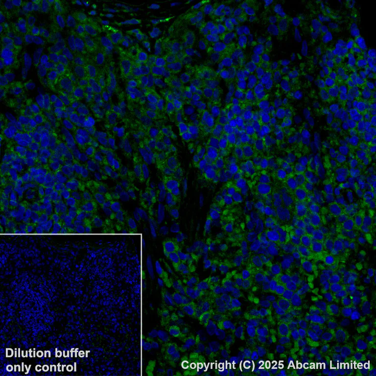 Immunohistochemistry (Formalin/PFA-fixed paraffin-embedded sections) - Alexa Fluor® 488 Anti-GPNMB antibody [EPR29063-10] (AB323762)