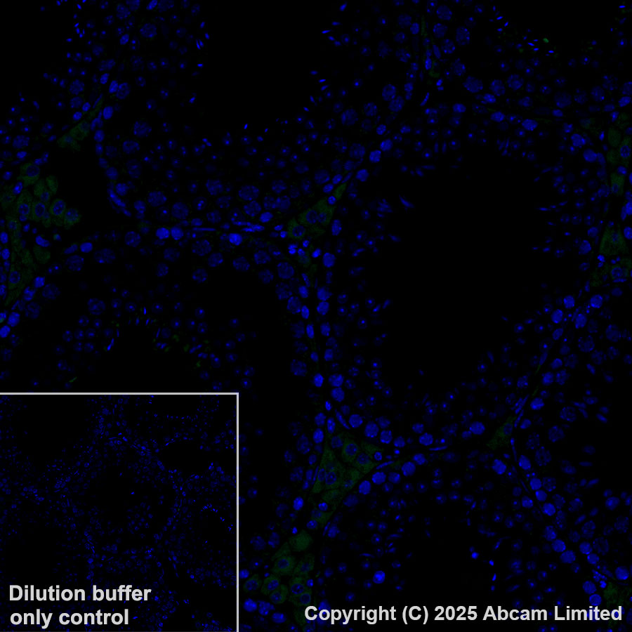 Immunohistochemistry (Formalin/PFA-fixed paraffin-embedded sections) - Alexa Fluor® 488 Anti-GPNMB antibody [EPR29063-10] (AB323762), expandable thumbnail