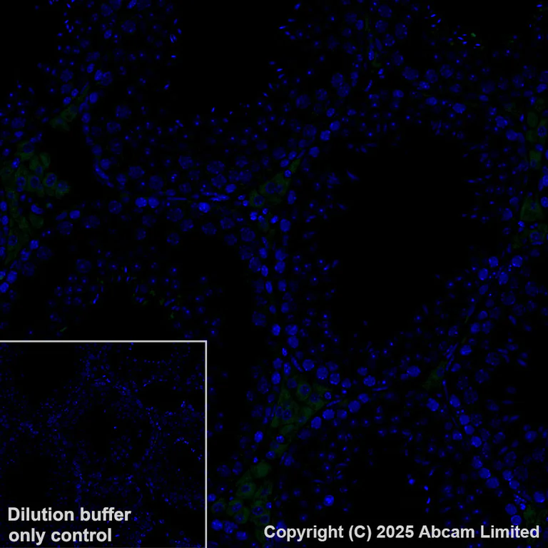 Immunohistochemistry (Formalin/PFA-fixed paraffin-embedded sections) - Alexa Fluor® 488 Anti-GPNMB antibody [EPR29063-10] (AB323762)