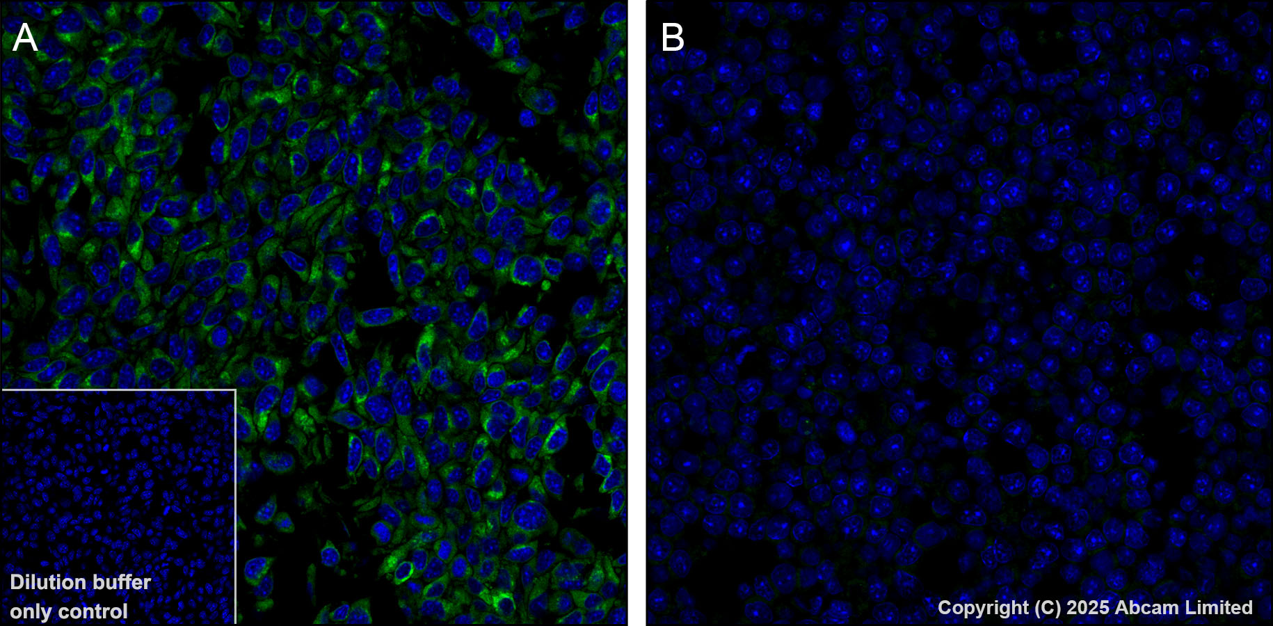 Immunohistochemistry (Formalin/PFA-fixed paraffin-embedded sections) - Alexa Fluor® 488 Anti-GPNMB antibody [EPR29063-10] (AB323762), expandable thumbnail