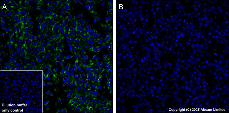 Immunohistochemistry (Formalin/PFA-fixed paraffin-embedded sections) - Alexa Fluor® 488 Anti-GPNMB antibody [EPR29063-10] (AB323762)