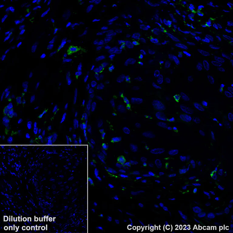 Immunohistochemistry (Formalin/PFA-fixed paraffin-embedded sections) - Alexa Fluor® 488 Anti-Granzyme B antibody [EPR20129-217] (AB225472)