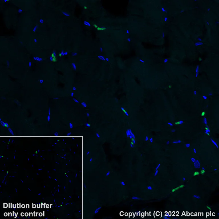 Immunohistochemistry (Formalin/PFA-fixed paraffin-embedded sections) - Alexa Fluor® 488 Anti-Granzyme B antibody [EPR8260] (AB315854)