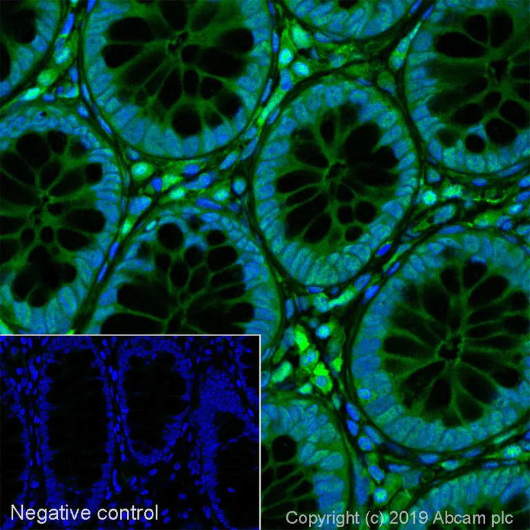 Immunohistochemistry (Formalin/PFA-fixed paraffin-embedded sections) - Alexa Fluor® 488 Anti-GRB2 antibody [Y237] (AB252037)