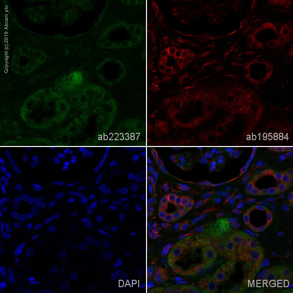 Immunohistochemistry (Formalin/PFA-fixed paraffin-embedded sections) - Alexa Fluor® 488 Anti-Hamartin antibody [EP318Y] (AB223387)