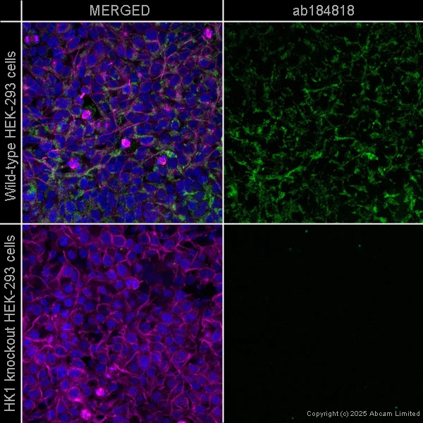 Immunocytochemistry/ Immunofluorescence - Alexa Fluor® 488 Anti-Hexokinase 1 antibody [EPR10134(B)] - Mitochondrial Outer Membrane Marker (AB184818)