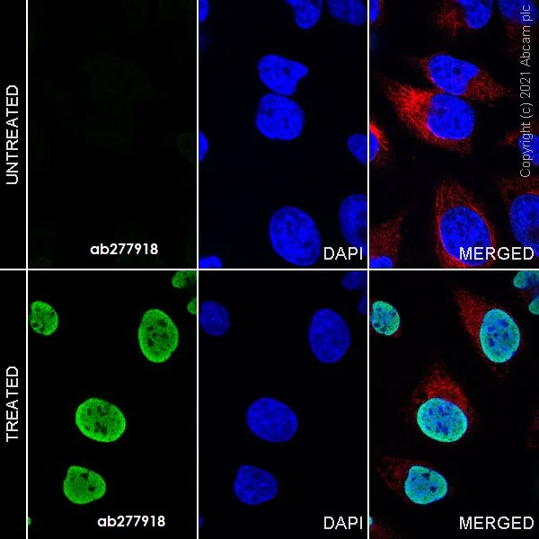Immunocytochemistry - Alexa Fluor® 488 Anti-Histone H3 (acetyl K14) antibody [EP964Y] (AB277918)
