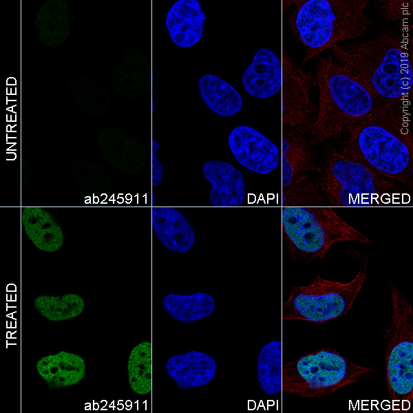Immunocytochemistry/ Immunofluorescence - Alexa Fluor® 488 Anti-Histone H3 (acetyl K27) antibody [EP16602] (AB245911)