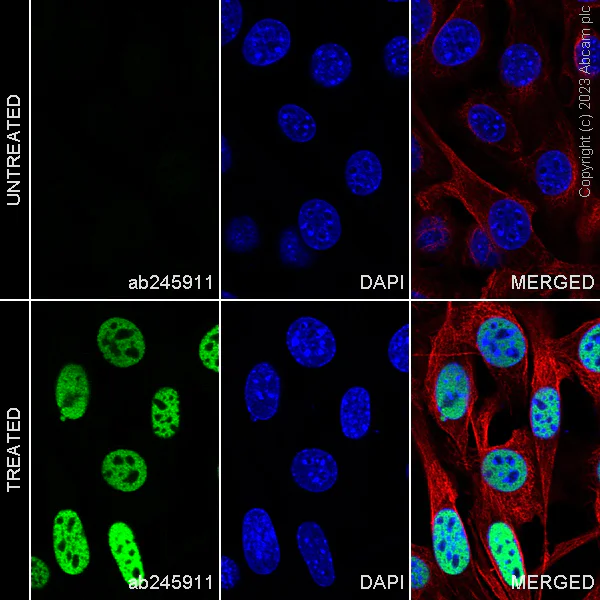 Immunocytochemistry/ Immunofluorescence - Alexa Fluor® 488 Anti-Histone H3 (acetyl K27) antibody [EP16602] (AB245911)
