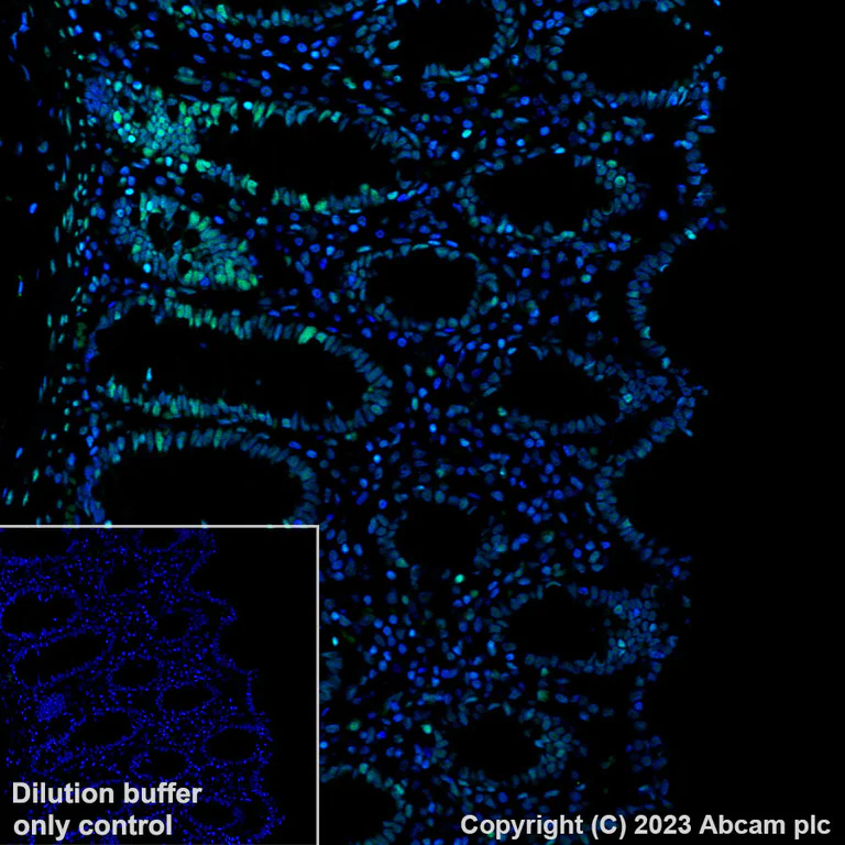 Immunohistochemistry (Formalin/PFA-fixed paraffin-embedded sections) - Alexa Fluor® 488 Anti-Histone H3 (acetyl K27) antibody [EP16602] (AB245911)