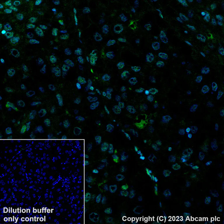 Immunohistochemistry (Formalin/PFA-fixed paraffin-embedded sections) - Alexa Fluor® 488 Anti-Histone H3 (acetyl K27) antibody [EP16602] (AB245911)
