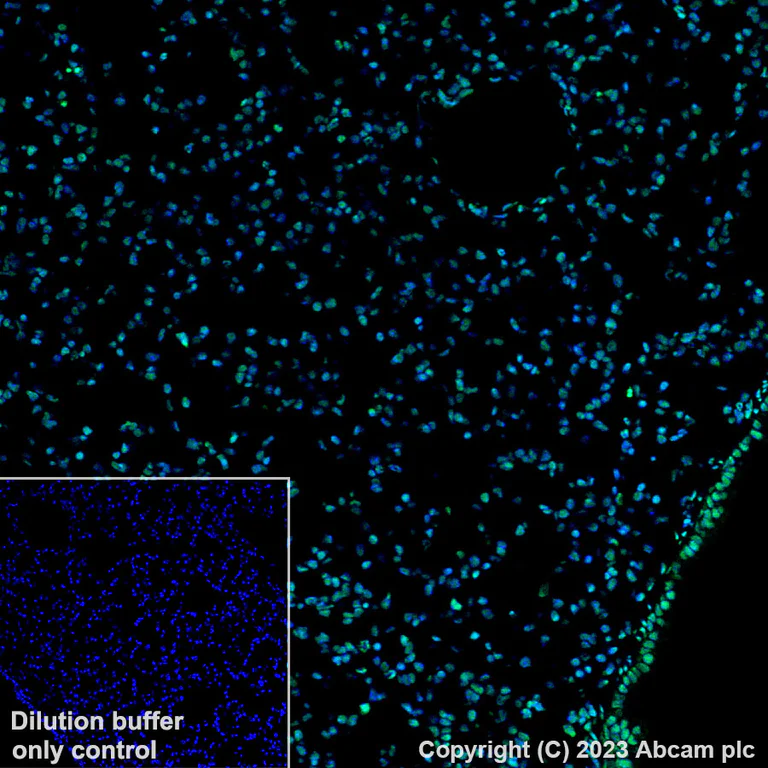 Immunohistochemistry (Formalin/PFA-fixed paraffin-embedded sections) - Alexa Fluor® 488 Anti-Histone H3 (acetyl K27) antibody [EP16602] (AB245911)