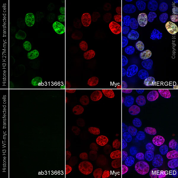 Immunocytochemistry/ Immunofluorescence - Alexa Fluor® 488 Anti-Histone H3 (mutated K27M) antibody [EPR18340] (AB313663)
