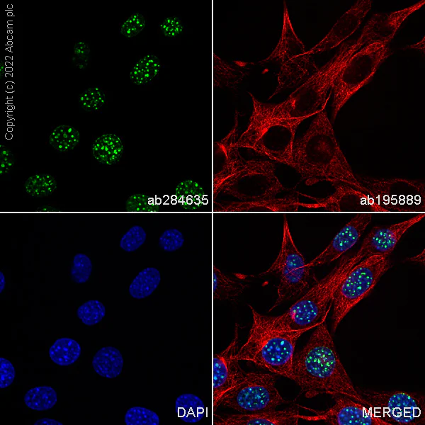 Immunocytochemistry/ Immunofluorescence - Alexa Fluor® 488 Anti-Histone H3 (tri methyl K9) antibody [EPR16601] - ChIP Grade (AB284635)