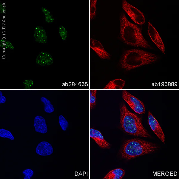Immunocytochemistry/ Immunofluorescence - Alexa Fluor® 488 Anti-Histone H3 (tri methyl K9) antibody [EPR16601] - ChIP Grade (AB284635)