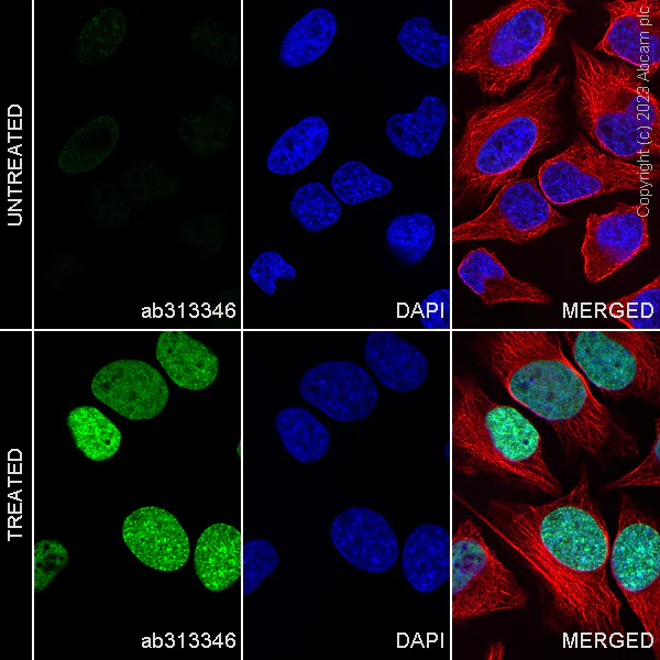 Immunocytochemistry/ Immunofluorescence - Alexa Fluor® 488 Anti-Histone H4 (acetyl K5) antibody [EP1000Y] (AB313346)