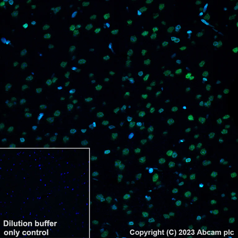 Immunohistochemistry (Formalin/PFA-fixed paraffin-embedded sections) - Alexa Fluor® 488 Anti-Histone H4 (acetyl K5) antibody [EP1000Y] (AB313346)