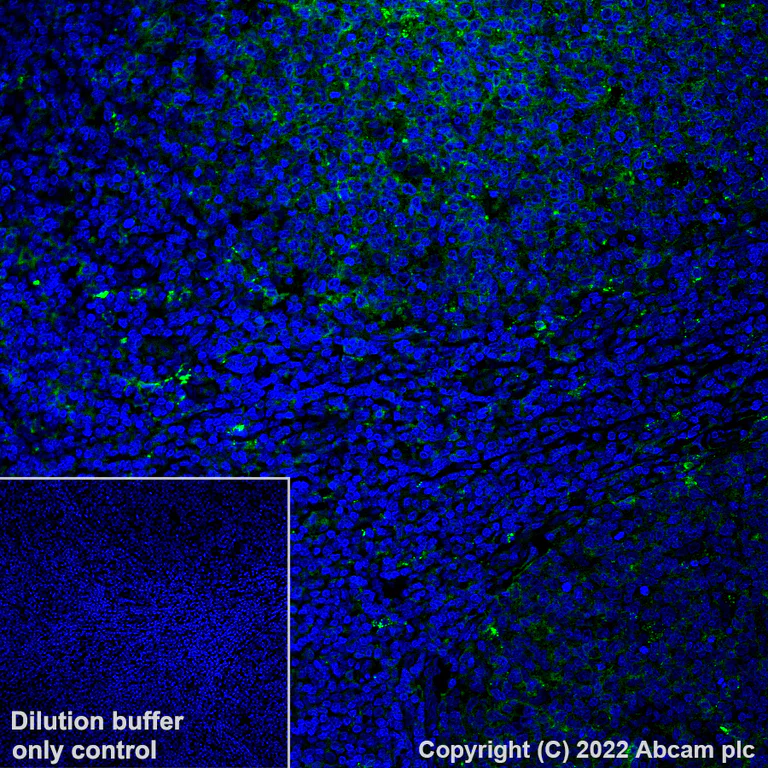 Immunohistochemistry (Formalin/PFA-fixed paraffin-embedded sections) - Alexa Fluor® 488 Anti-HLA-DR antibody [EPR3692] (AB307775)