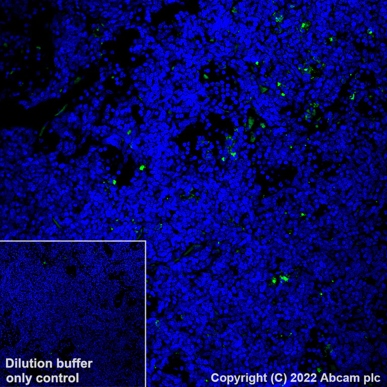 Immunohistochemistry (Formalin/PFA-fixed paraffin-embedded sections) - Alexa Fluor® 488 Anti-HLA-DR antibody [EPR3692] (AB307775)