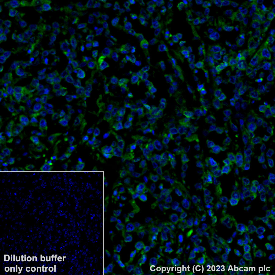 Immunohistochemistry (Formalin/PFA-fixed paraffin-embedded sections) - Alexa Fluor® 488 Anti-HLA-DR antibody [TAL 1B5] (AB309369), expandable thumbnail