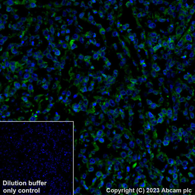 Immunohistochemistry (Formalin/PFA-fixed paraffin-embedded sections) - Alexa Fluor® 488 Anti-HLA-DR antibody [TAL 1B5] (AB309369)