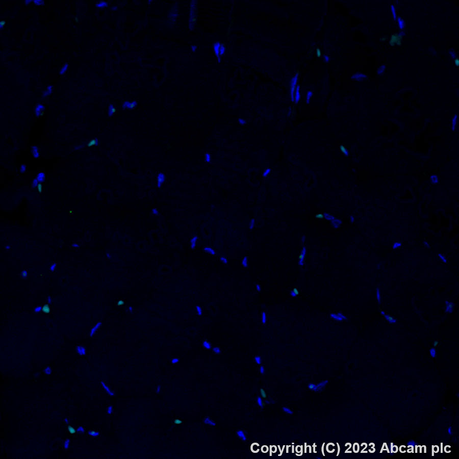 Immunohistochemistry (Formalin/PFA-fixed paraffin-embedded sections) - Alexa Fluor® 488 Anti-HLA-DR antibody [TAL 1B5] (AB309369), expandable thumbnail