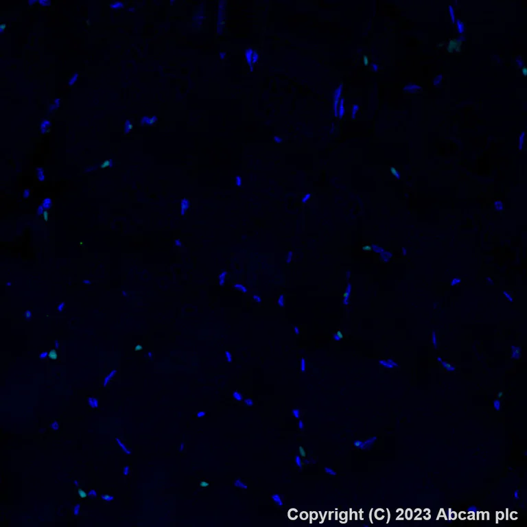 Immunohistochemistry (Formalin/PFA-fixed paraffin-embedded sections) - Alexa Fluor® 488 Anti-HLA-DR antibody [TAL 1B5] (AB309369)