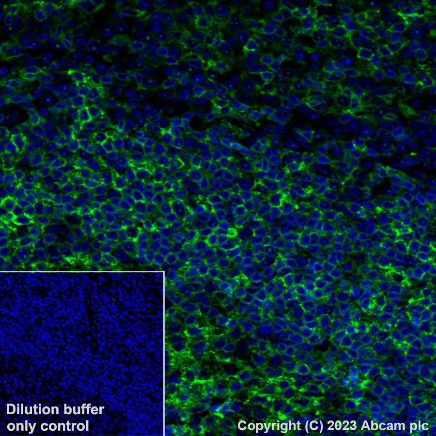 Immunohistochemistry (Formalin/PFA-fixed paraffin-embedded sections) - Alexa Fluor® 488 Anti-HLA-DR antibody [TAL 1B5] (AB309369), expandable thumbnail