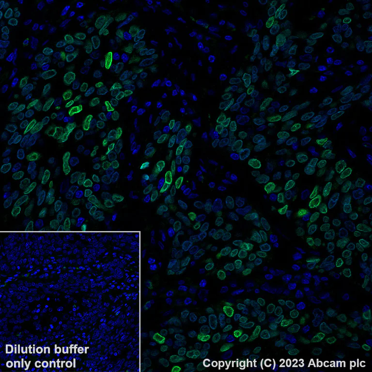 Immunohistochemistry (Formalin/PFA-fixed paraffin-embedded sections) - Alexa Fluor® 488 Anti-HMGA2 antibody [EPR18114] (AB317357)