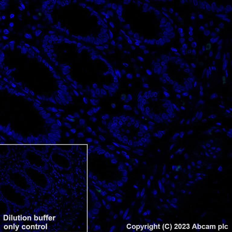 Immunohistochemistry (Formalin/PFA-fixed paraffin-embedded sections) - Alexa Fluor® 488 Anti-HMGA2 antibody [EPR18114] (AB317357)