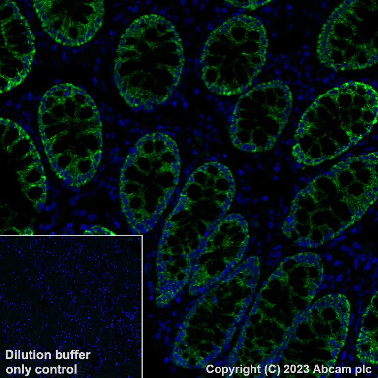 Immunohistochemistry (Formalin/PFA-fixed paraffin-embedded sections) - Alexa Fluor® 488 Anti-HMGCS2 antibody [EPR8642] (AB309164)