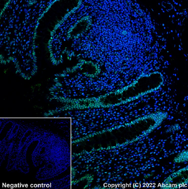 Immunohistochemistry (Formalin/PFA-fixed paraffin-embedded sections) - Alexa Fluor® 488 Anti-hnRNP A2B1 antibody [EPR24002-81] (AB302973), expandable thumbnail