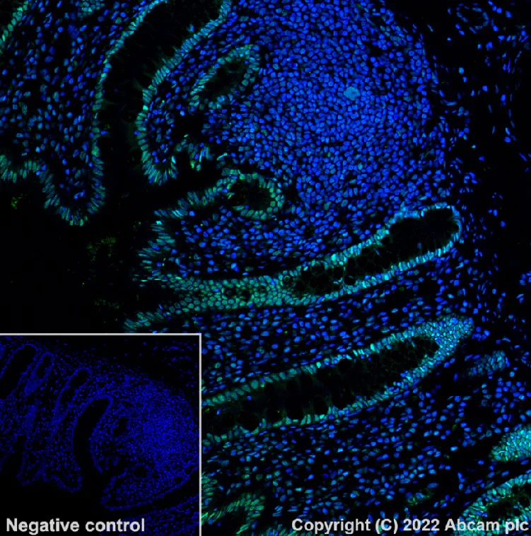 Immunohistochemistry (Formalin/PFA-fixed paraffin-embedded sections) - Alexa Fluor® 488 Anti-hnRNP A2B1 antibody [EPR24002-81] (AB302973)