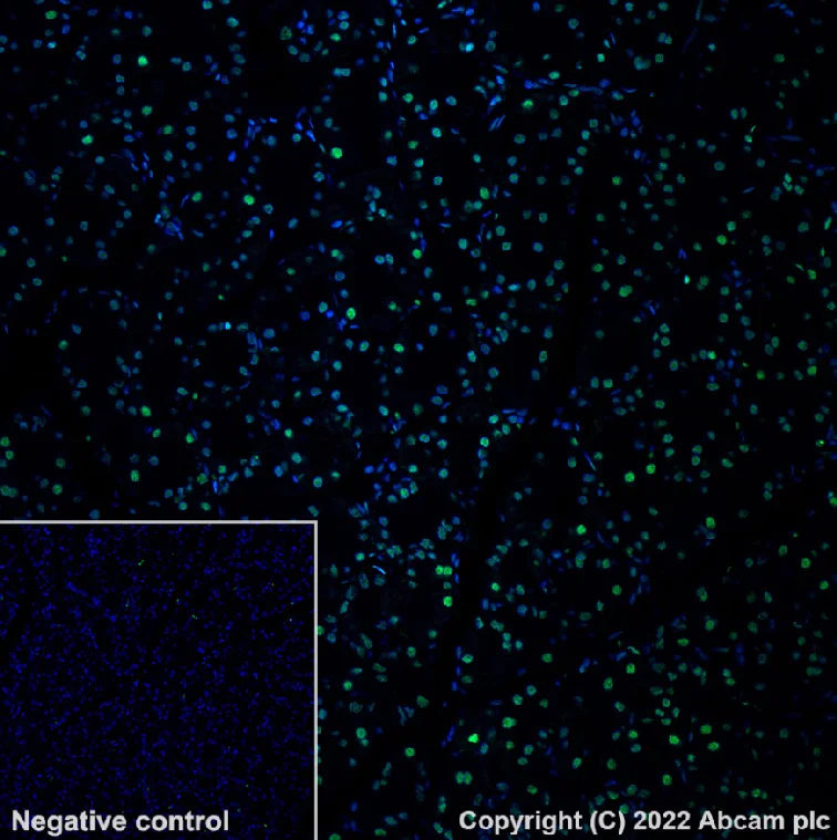 Immunohistochemistry (Formalin/PFA-fixed paraffin-embedded sections) - Alexa Fluor® 488 Anti-hnRNP A2B1 antibody [EPR24002-81] (AB302973)