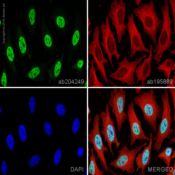 Immunocytochemistry/ Immunofluorescence - Alexa Fluor® 488 Anti-hnRNP K antibody [F45 P9 C7] (AB204249)