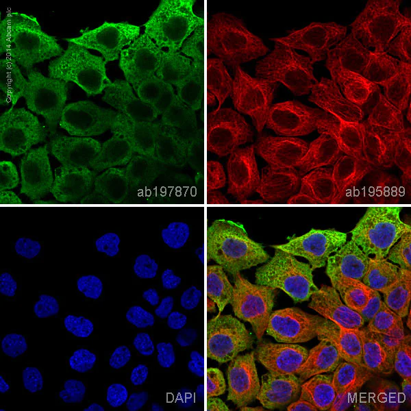 Immunocytochemistry/ Immunofluorescence - Alexa Fluor® 488 Anti-Hsp70 antibody [EP1007Y] (AB197870)