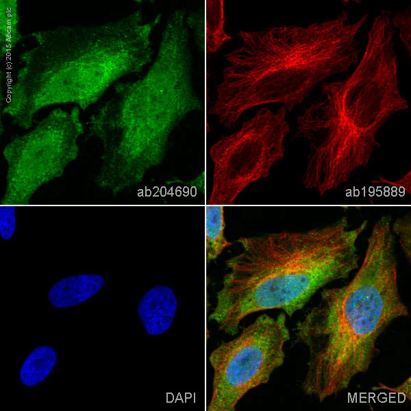 Immunocytochemistry/ Immunofluorescence - Alexa Fluor® 488 Anti-Hsp70 antibody [EPR16892] (AB204690)