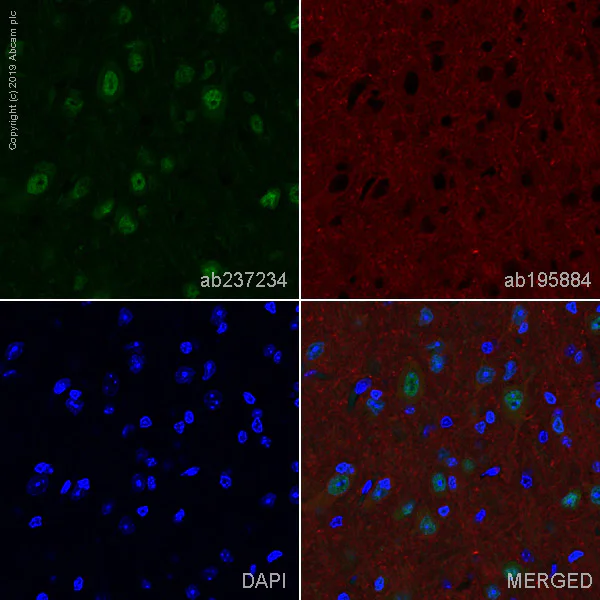 Immunohistochemistry (Formalin/PFA-fixed paraffin-embedded sections) - Alexa Fluor® 488 Anti-HuD + HuC antibody [EPR19098] (AB237234)