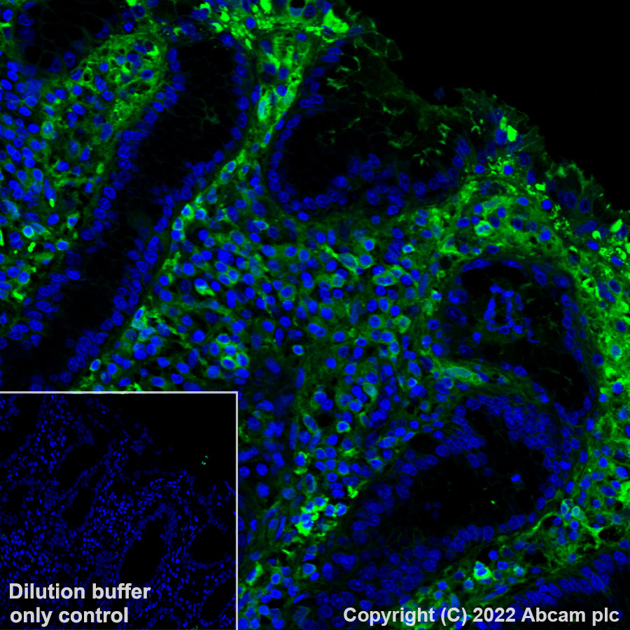 Immunohistochemistry - Alexa Fluor® 488 Anti-Human IgG antibody [EPR4421] (AB307524), expandable thumbnail